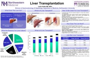 liver transplantation