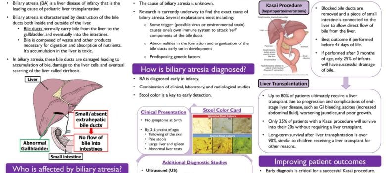 biliary atresia