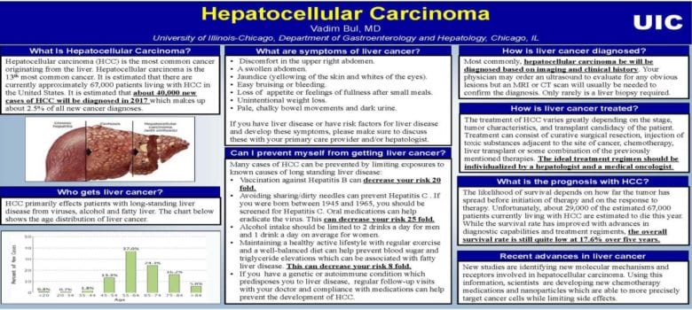 liver cancer