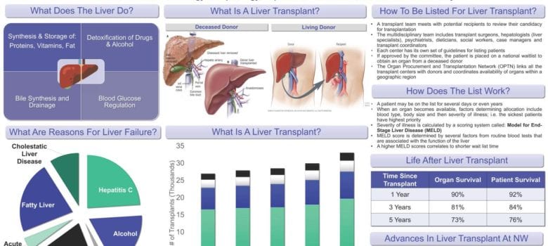 liver transplantation