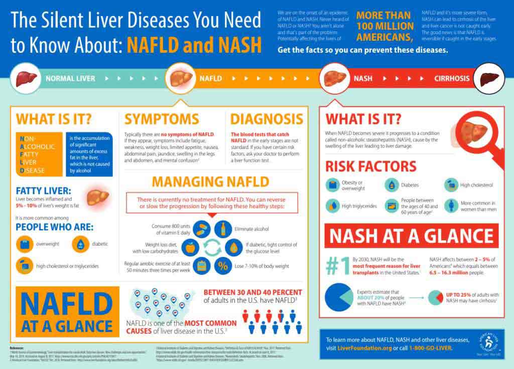 NASH infographic