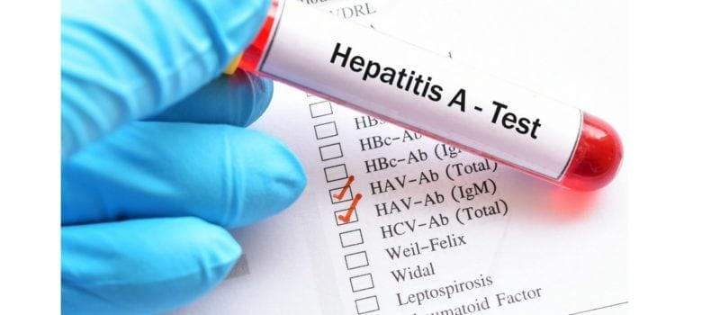 Hepatitis A Test