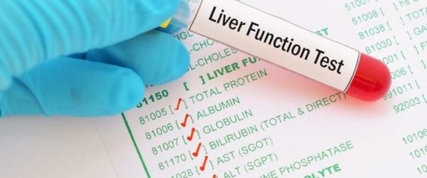 Liver Function tests