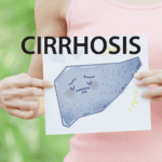 Cirrhosis Blog